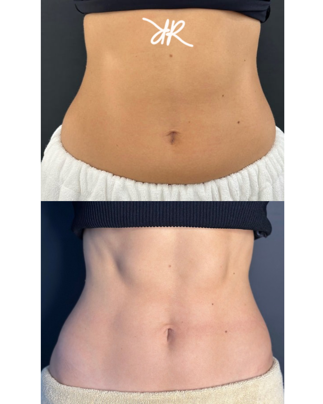 primex before_after